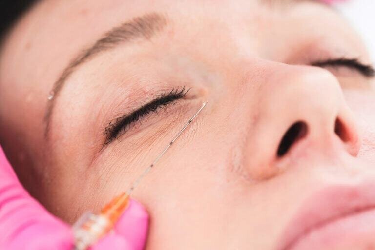 What Is The Difference Between Dermal Fillers And Botox?