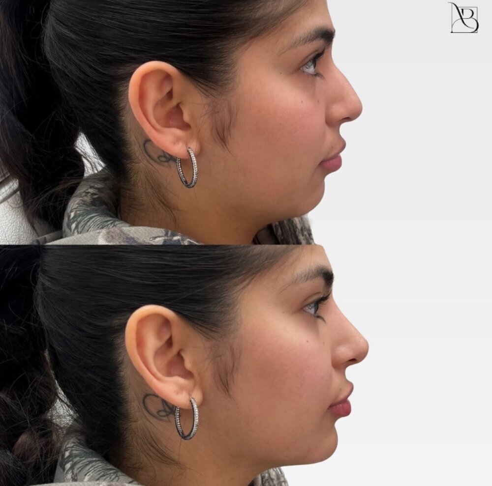 profile balance Before & After Image